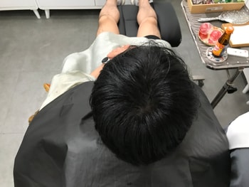 시술 후