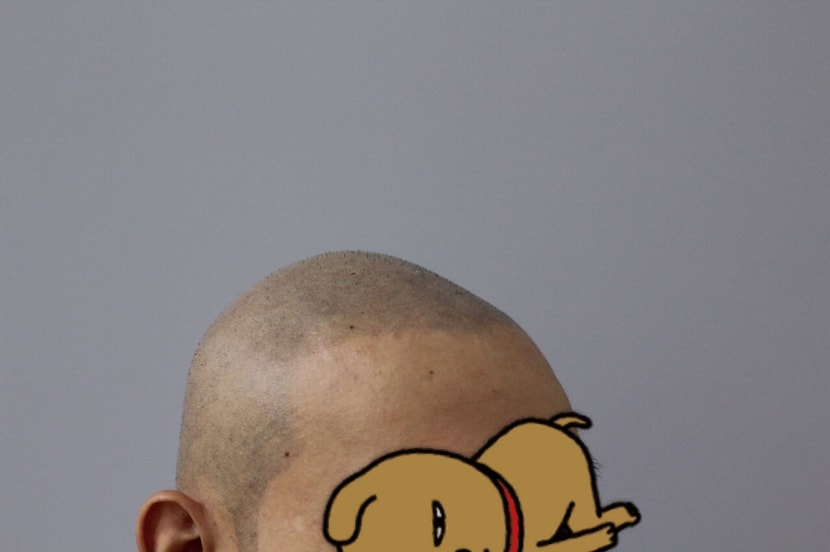 시술후
