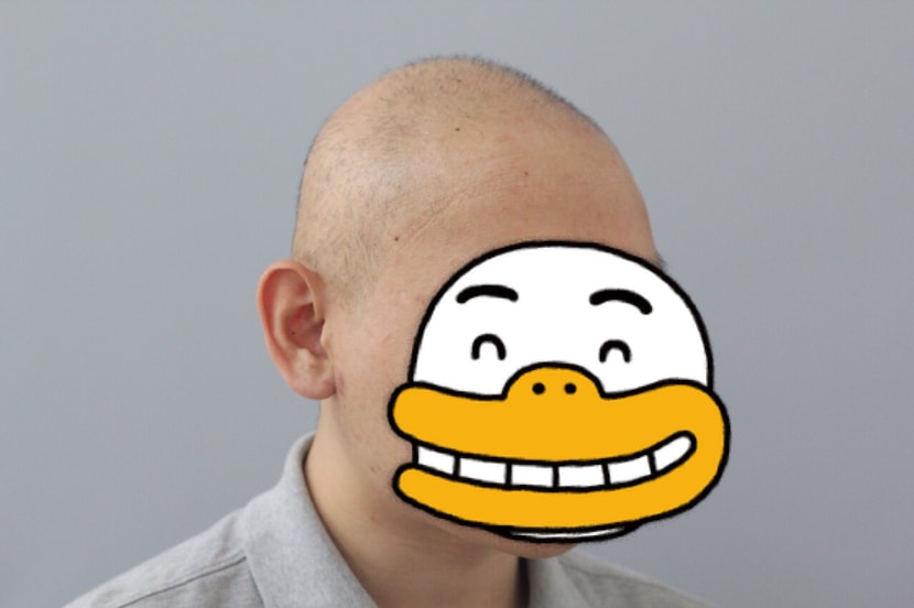 시술전