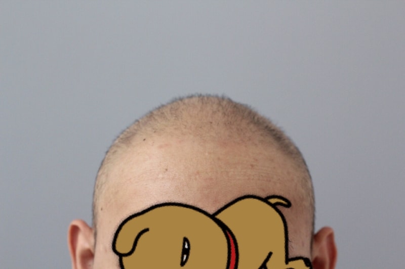 完全光头皮纹身的最终后记~ (包括手术前的照片)