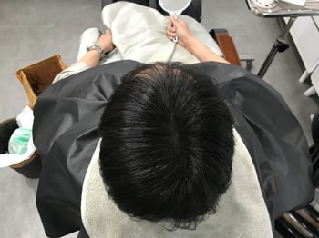 (시술후)