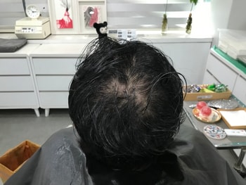 시술 전 (물에 젖은)