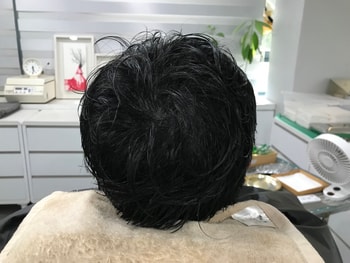 시술 후 (물에 젖은)