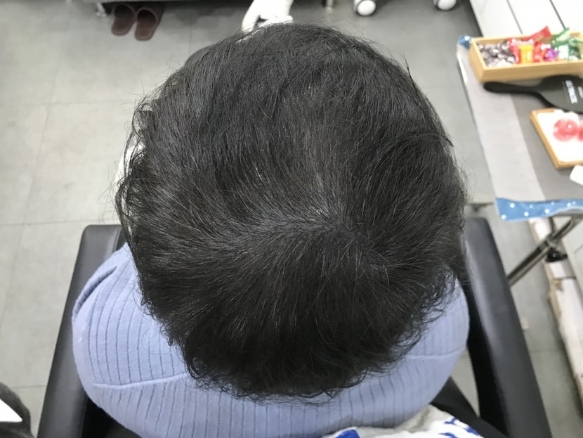 최근 사진
