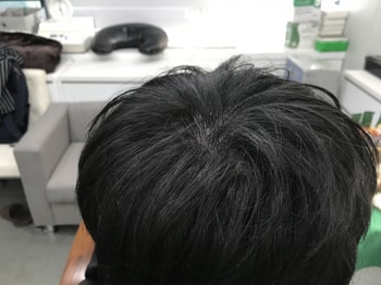 시술후 병원