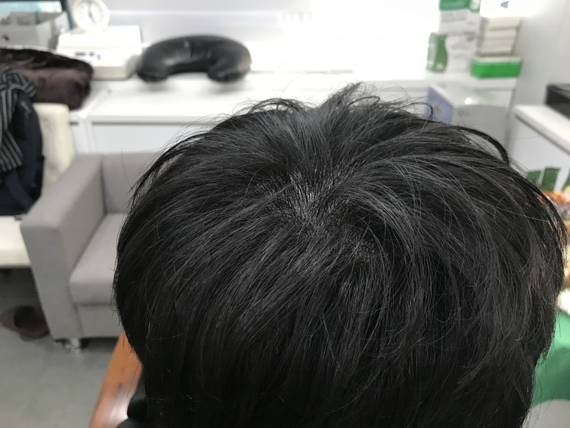 시술후 병원