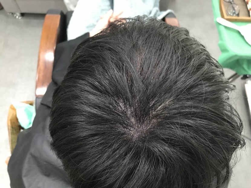 시술후 병원