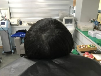 보강시술 전