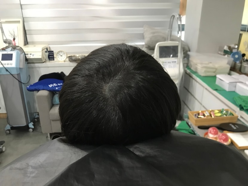 보강시술 전