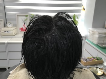두피문신 후
