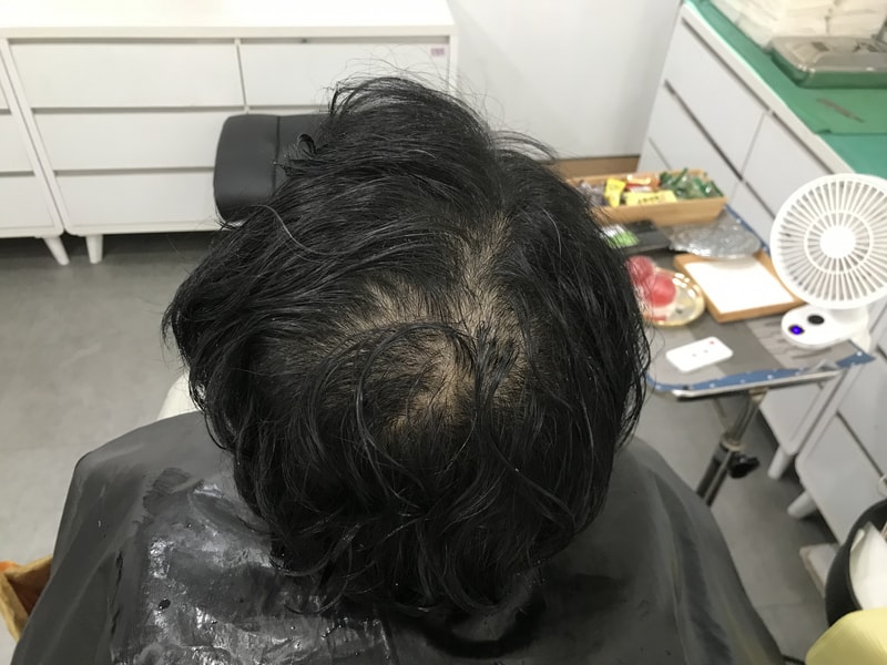 연세미다인 정수리 후기
