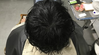 후
