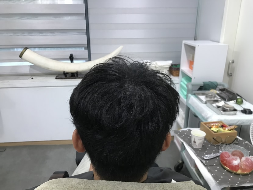 후