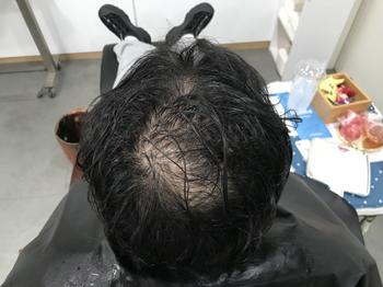 시술전 물에젖은 상태