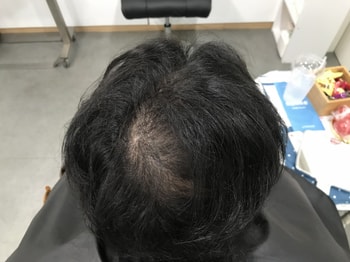 시술전 평소