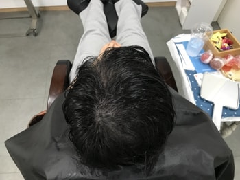 시술후 물에젖은상태