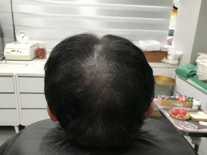 타병원들에서 시술 후 사진