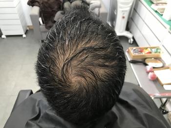 시술전 젖은상태