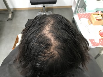 문신 전 젖은머리