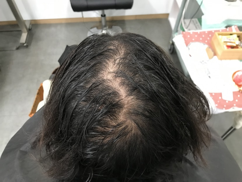 문신 전 젖은머리