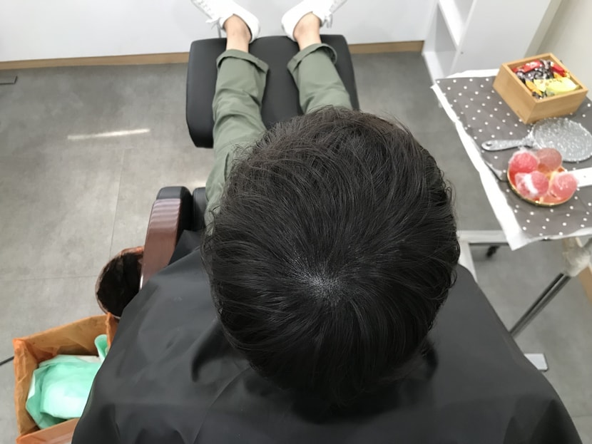 리터치 후