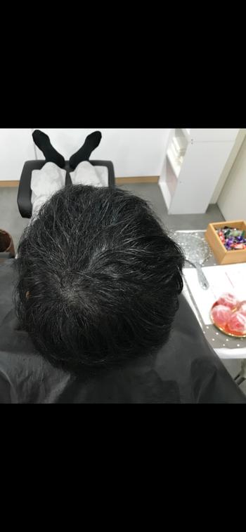 시술 전 상태