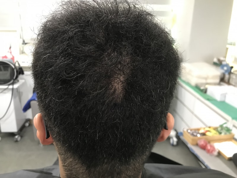 延世大学渐变圆点后期