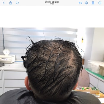 시술 전 젖은 상태 뒤