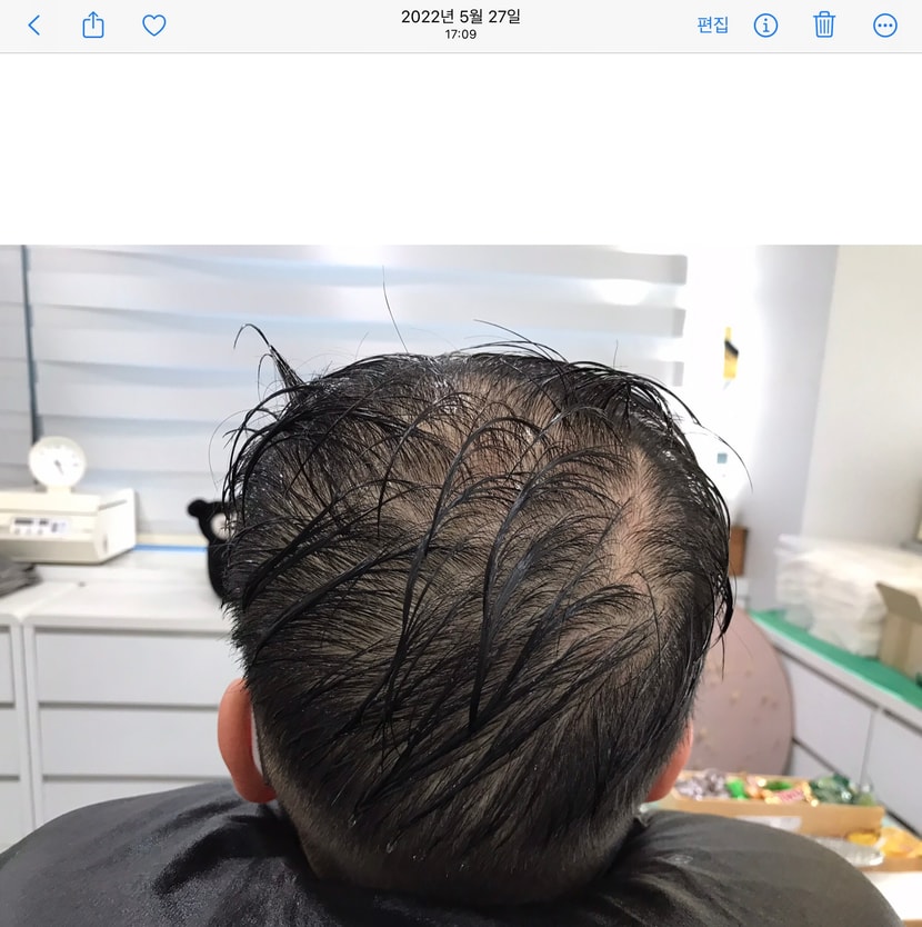 시술 전 젖은 상태 뒤