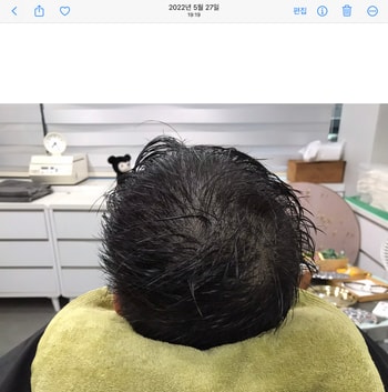 시술 후 젖은 상태 뒤