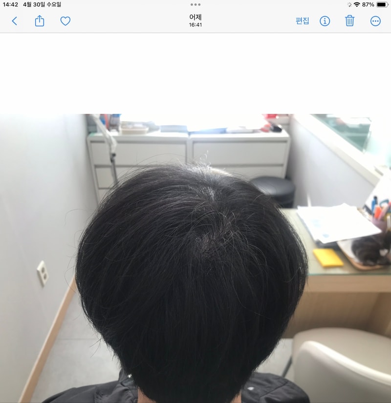 1년차 후기