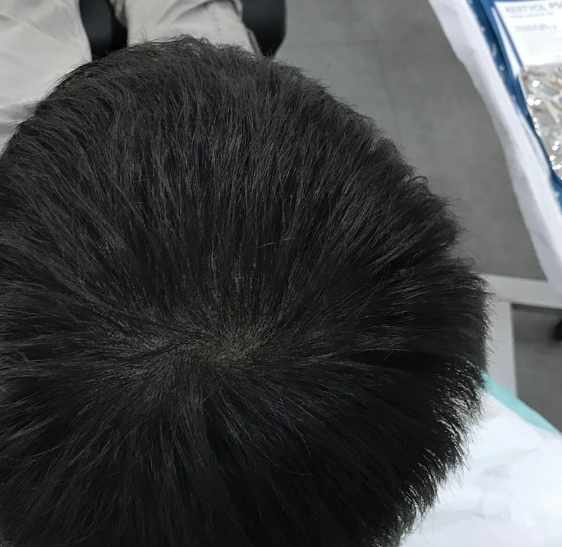 Yonsei Midain Retouch Review