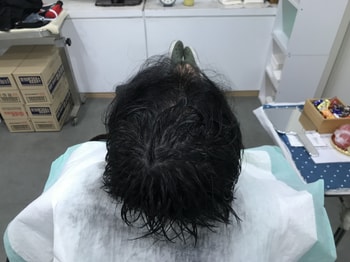 리터치후