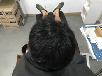 시술전