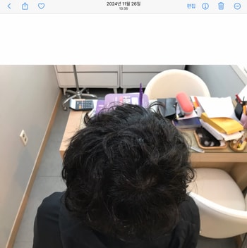 시술후