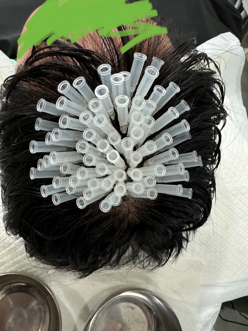 &lt;잔머리 재생술&gt;