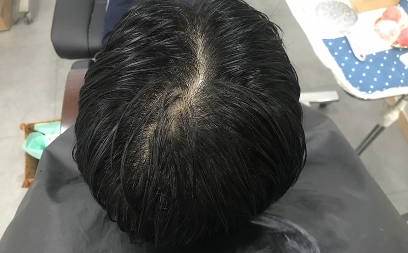 before