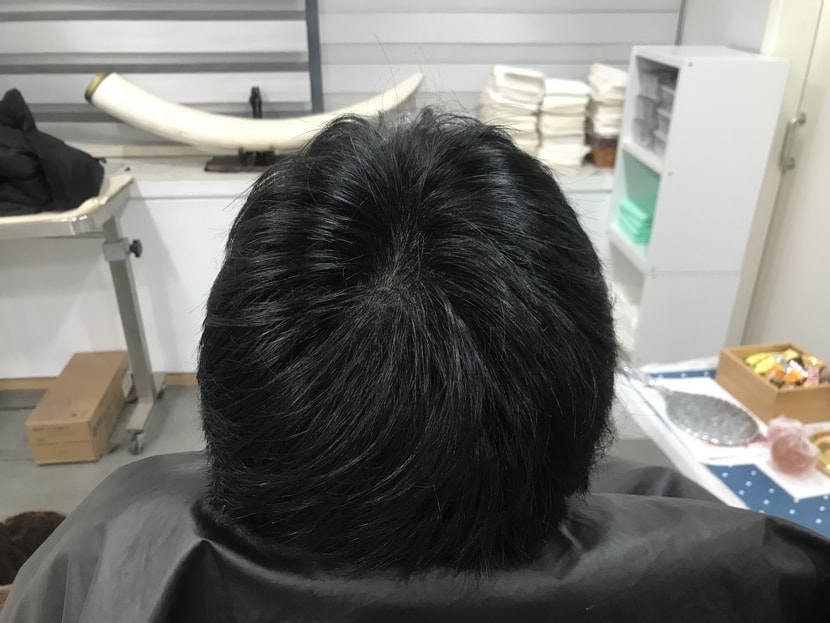 after