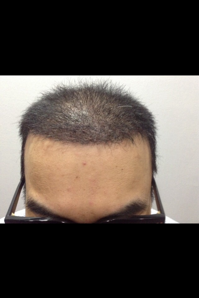 after