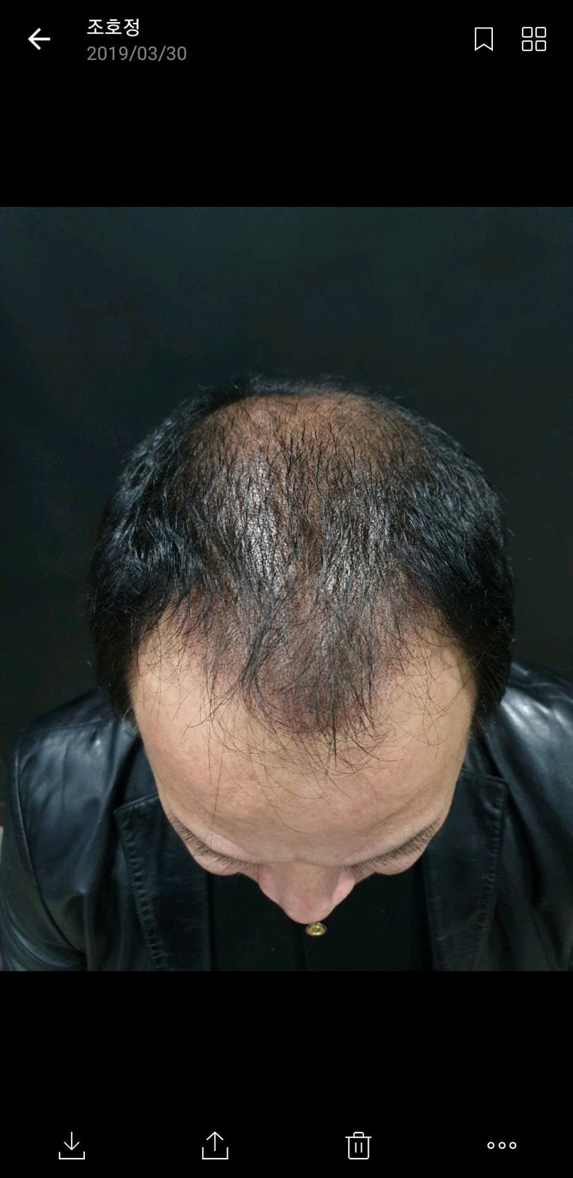 1차후샷