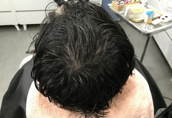 시술 후 젖은머리