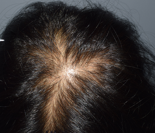 已经做完第3次手术了