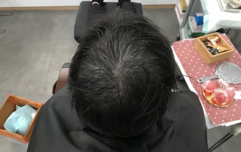 리터치 전