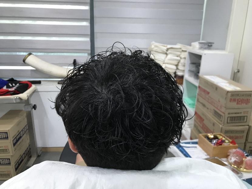 후