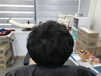 후