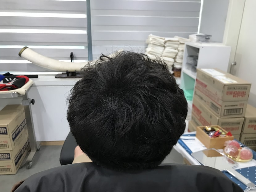 후