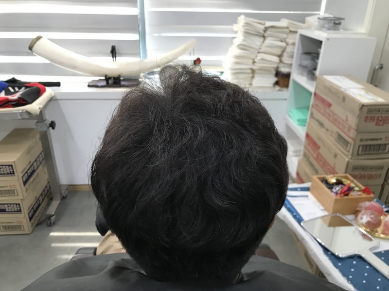 Yonsei Midine's scalp tattoo 2nd retouch review