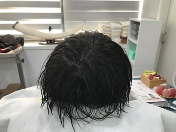 리터치후1
