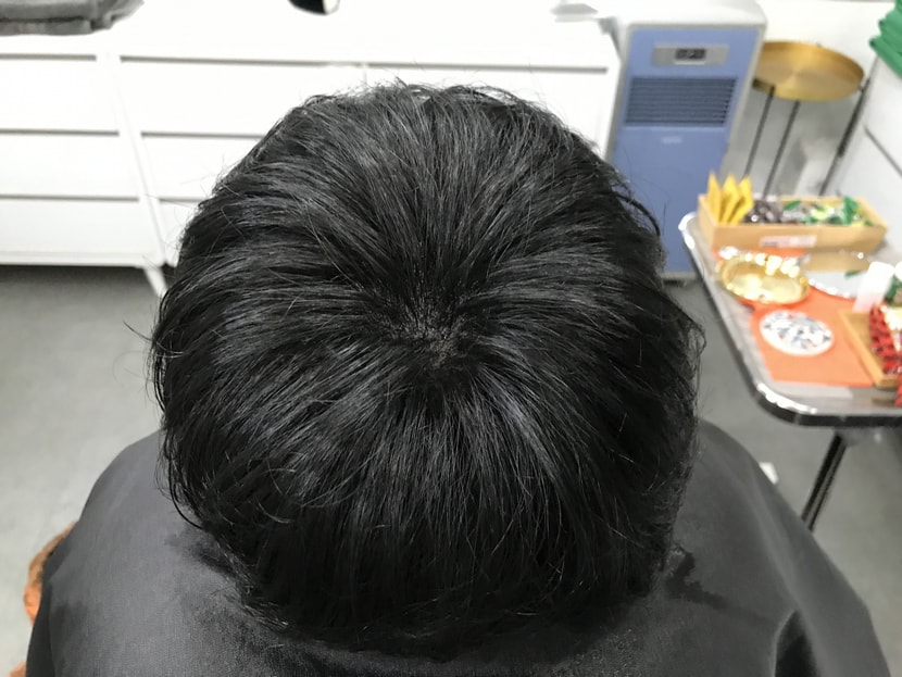 1차 후 