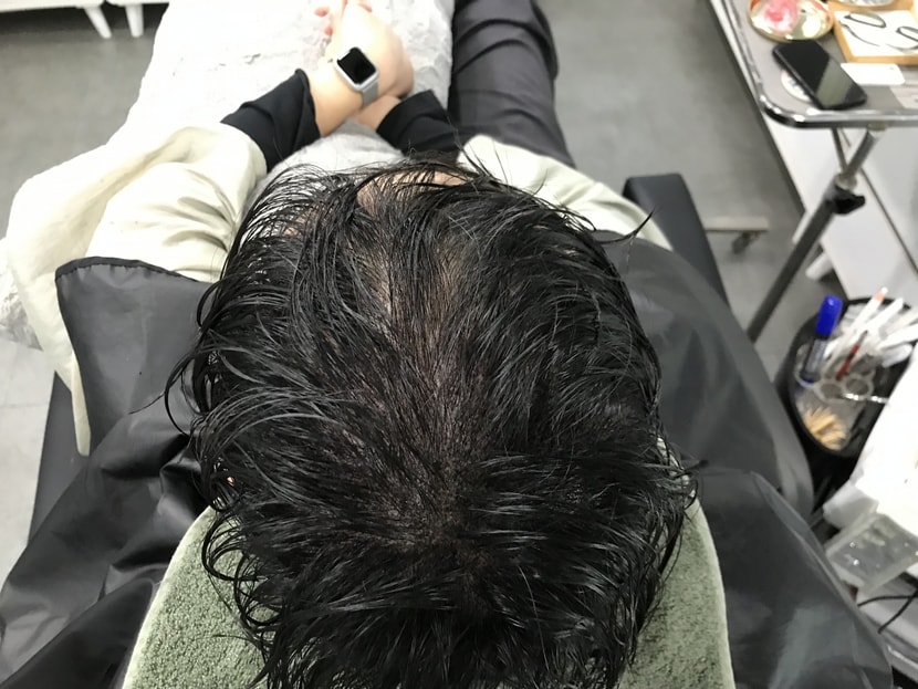후